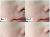 Transform Your Skin in Just 7 Days with These Two Unique Beauty Hacks – “smooth, poreless texture and glowing skin”