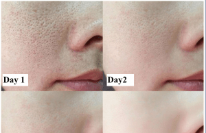 Transform Your Skin in Just 7 Days with These Two Unique Beauty Hacks – “smooth, poreless texture and glowing skin”