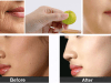Having these 5 Indian Fruits Can improve Complexion dramatically And make you Look 5 years Younger!