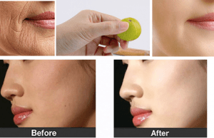 Having these 5 Indian Fruits Can improve Complexion dramatically And make you Look 5 years Younger!