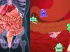 7 Bad Signs of an unhealthy gut, Do this to improve it naturally