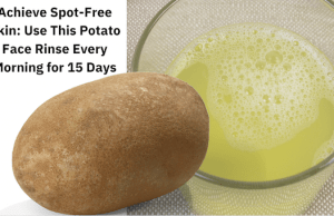 Get Crystal Clear Complexion & Remove Dark Spots with this Potato Skin Rinse Recipe