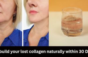 Do these 5 things to rebuild your lost collagen naturally within a month
