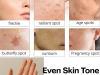 A Game-Changing Solution for Even Skin Tone Treatment
