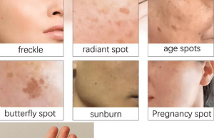 A Game-Changing Solution for Even Skin Tone Treatment