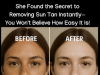 She Found the Secret to Removing Sun Tan Instantly—You Won’t Believe How Easy It Is!